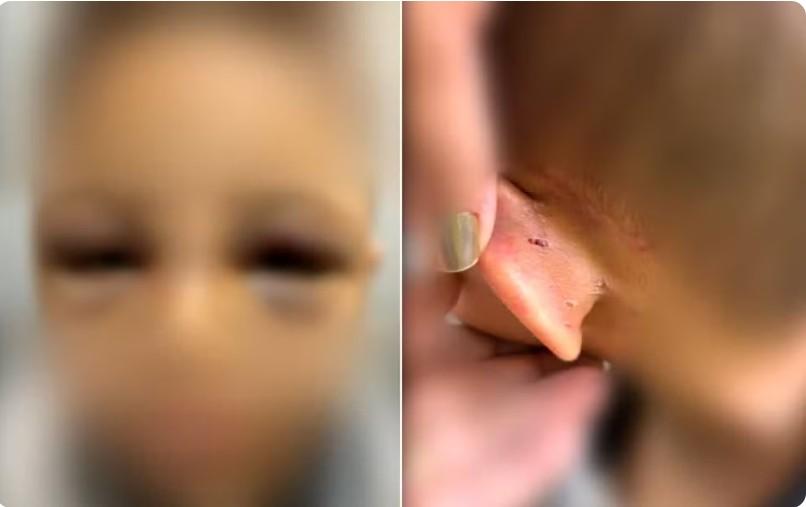 Pai é preso suspeito de espancar filho de 6 anos em Goiânia