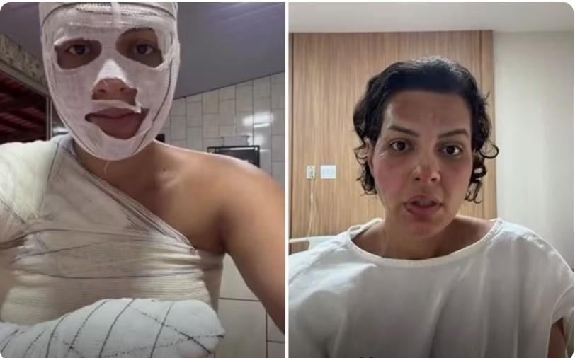 Nutricionista sofre queimaduras graves durante faxina na casa da mãe e faz alerta