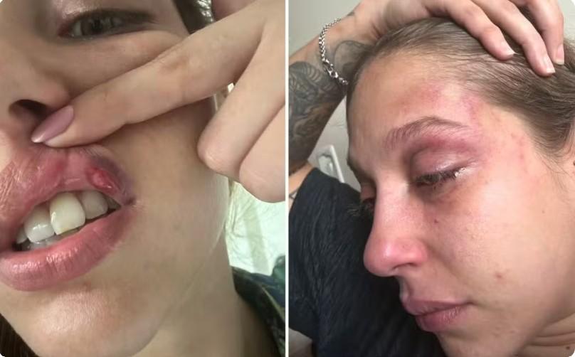 Jovem denuncia empresário por série de socos durante agressão em Goiânia