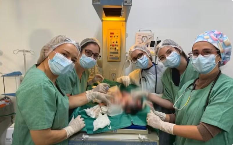 Médicos consideram complexo caso de bebês siameses unidos pelo abdômen em Goiânia