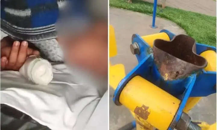 Criança de seis anos tem parte de dedo amputada após acidente em aparelho de ginástica em Itaberaí