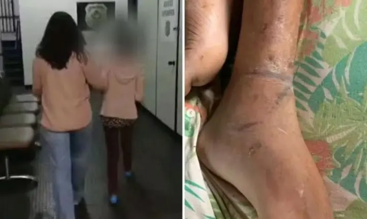Filho mantido acorrentado pela mãe em Rio Verde sofreu três AVCs, diz polícia