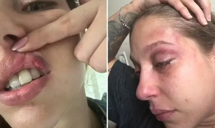Jovem denuncia empresário por série de socos durante agressão em Goiânia