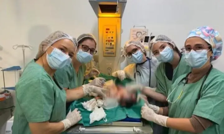 Médicos consideram complexo caso de bebês siameses unidos pelo abdômen em Goiânia