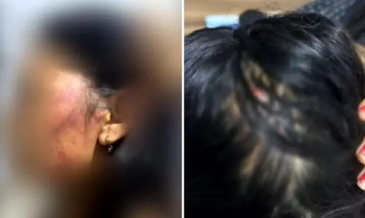 Mulher pula de moto em movimento para escapar de estupro e agressões em Nova Crixás