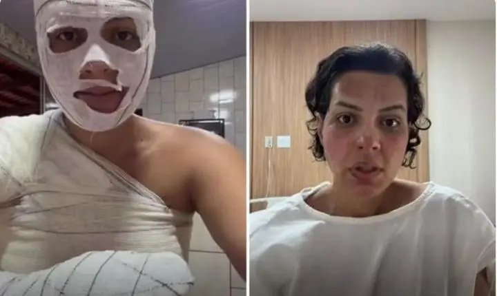 Nutricionista sofre queimaduras graves durante faxina na casa da mãe e faz alerta